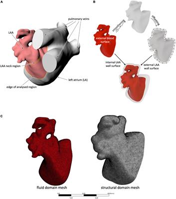 The Role of Patient-Specific Morphological Features of the Left Atrial Appendage on the Thromboembolic Risk Under Atrial Fibrillation